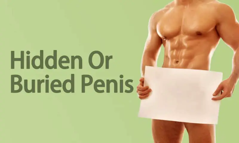 man holding a sign above penis