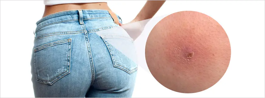 Low butt crack irritation in a jean